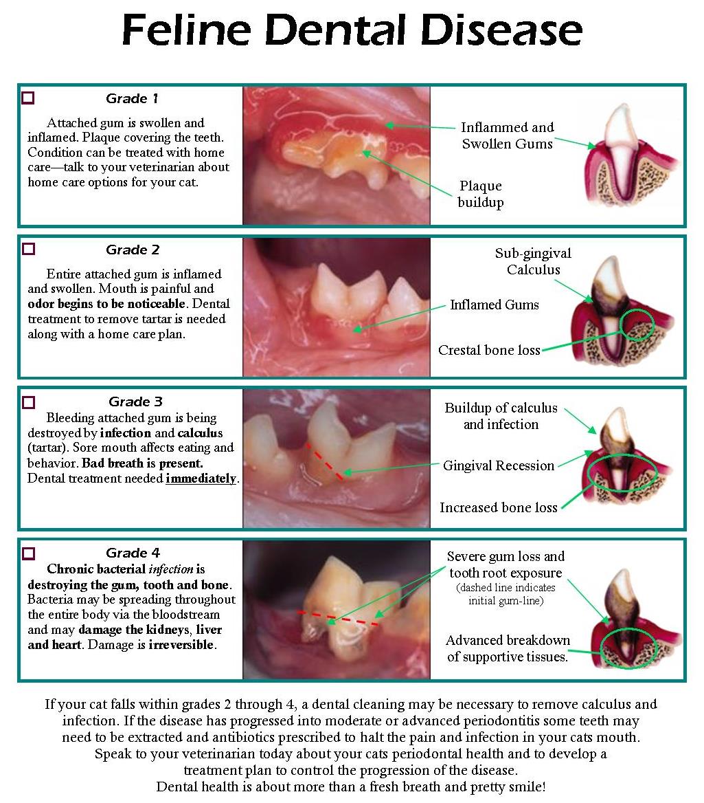 Tartar Removal Techniques